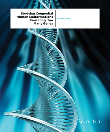 Dr Heiko Reutter – Studying Congenital Human Malformations Caused By Too Many Genes