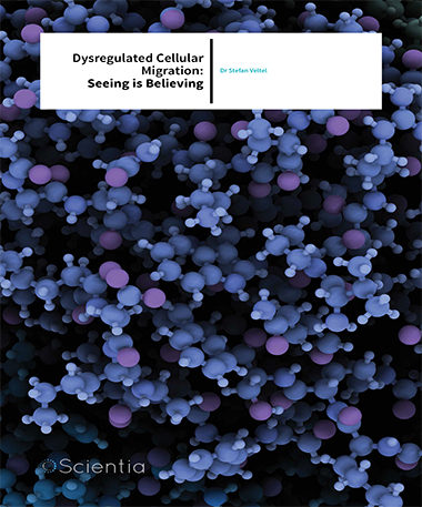 Dr Stefan Veltel – Dysregulated Cellular Migration: Seeing is Believing