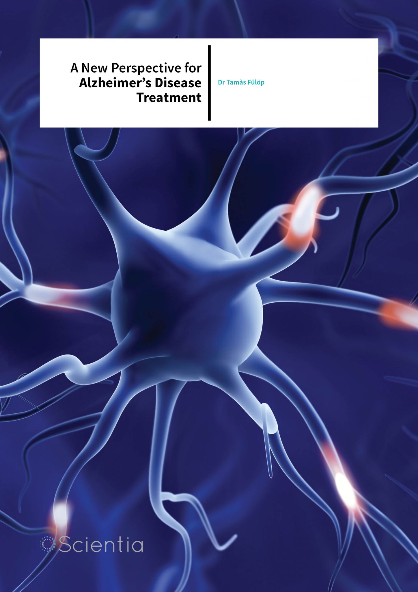 Dr Tamàs Fülöp – A New Perspective For Alzheimer’s Disease Treatment