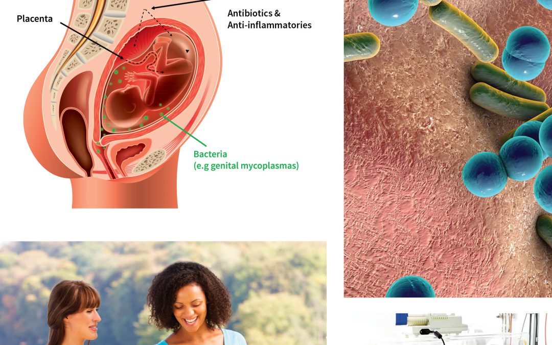 Professor Jeff Keelan – Preventing Preterm Birth and Improving Infant Outcomes