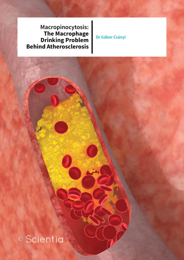 Dr Gábor Csányi – Macropinocytosis: The Macrophage Drinking Problem Behind Atherosclerosis