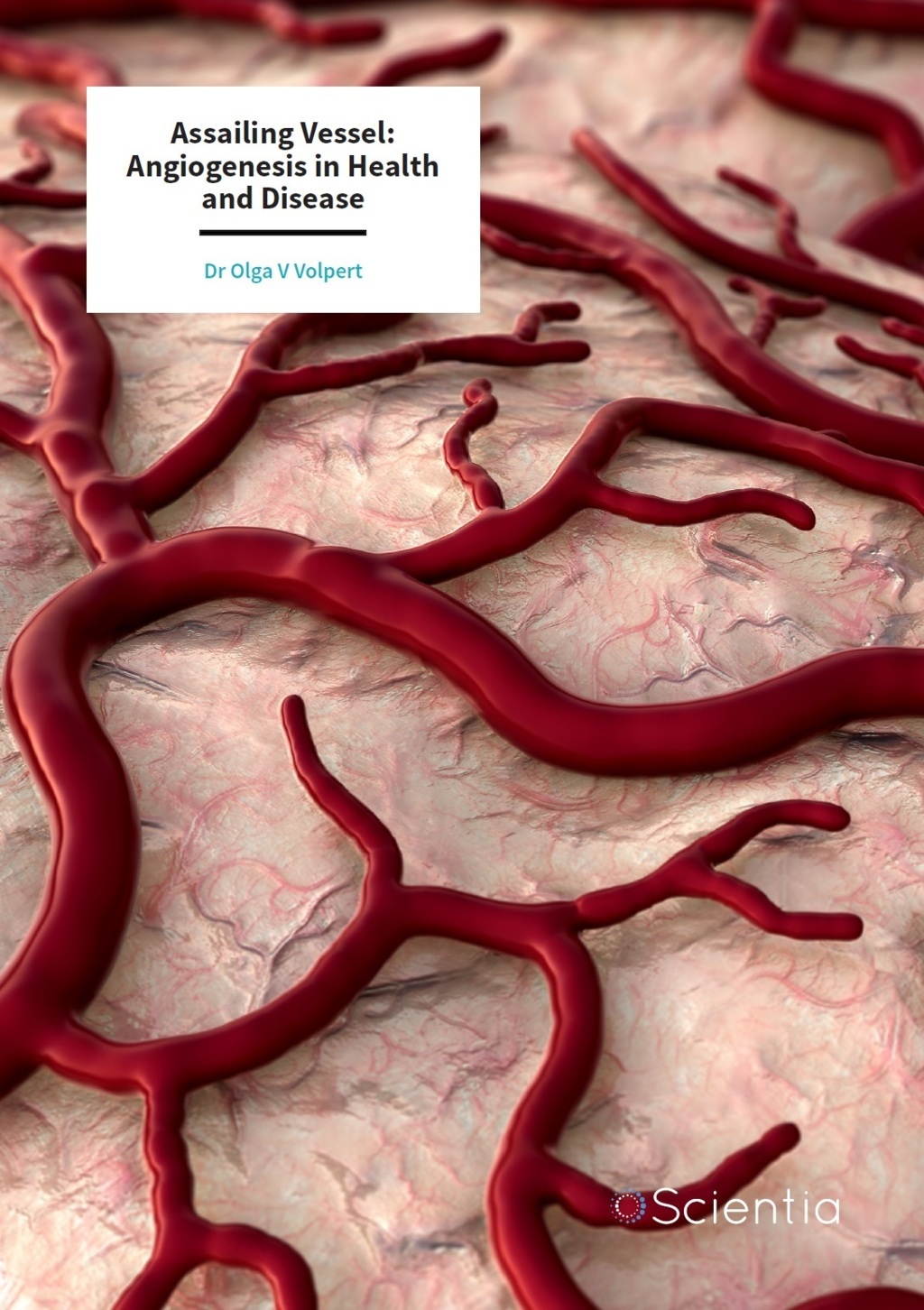 Dr Olga Volpert  – Assailing Vessel: Angiogenesis in Health and Disease