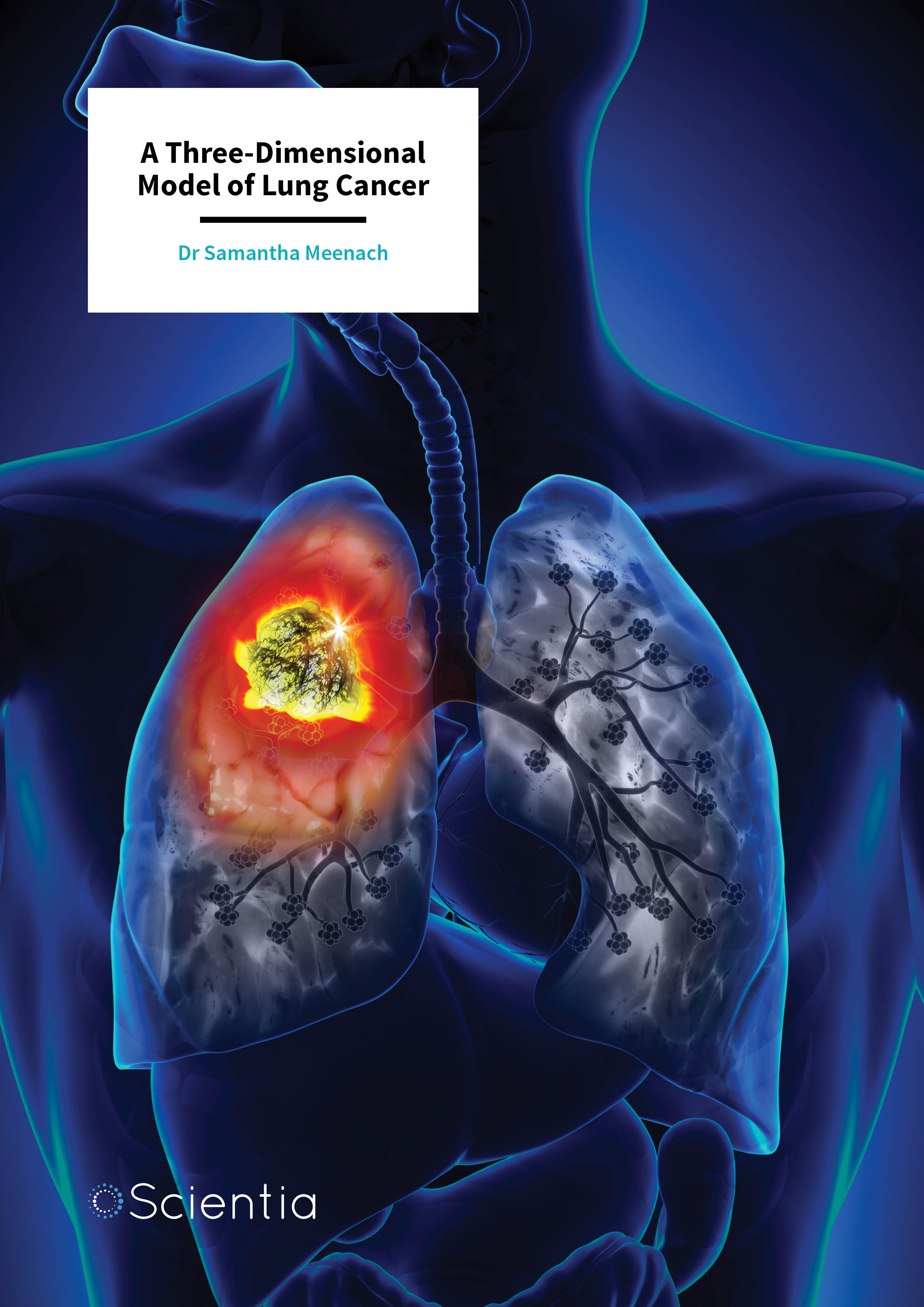 Dr Samantha Meenach – A Three-Dimensional Model of Lung Cancer