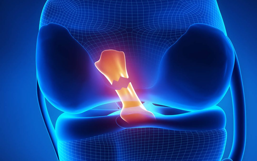 Dr Alan Barhorst | How Robots Are Helping Us Understand Knee Injuries