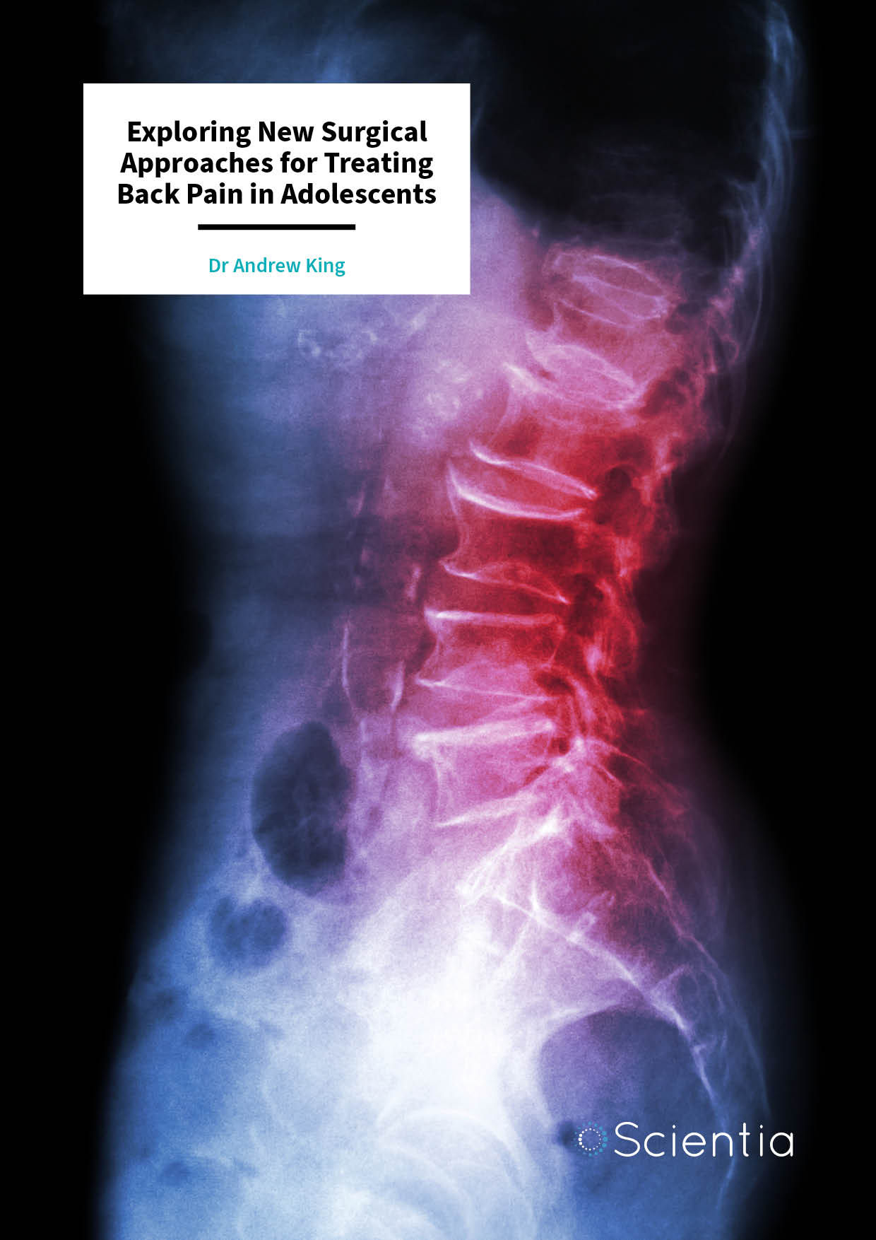 Dr Andrew King | Exploring New Surgical Approaches For Treating Back Pain In Adolescents
