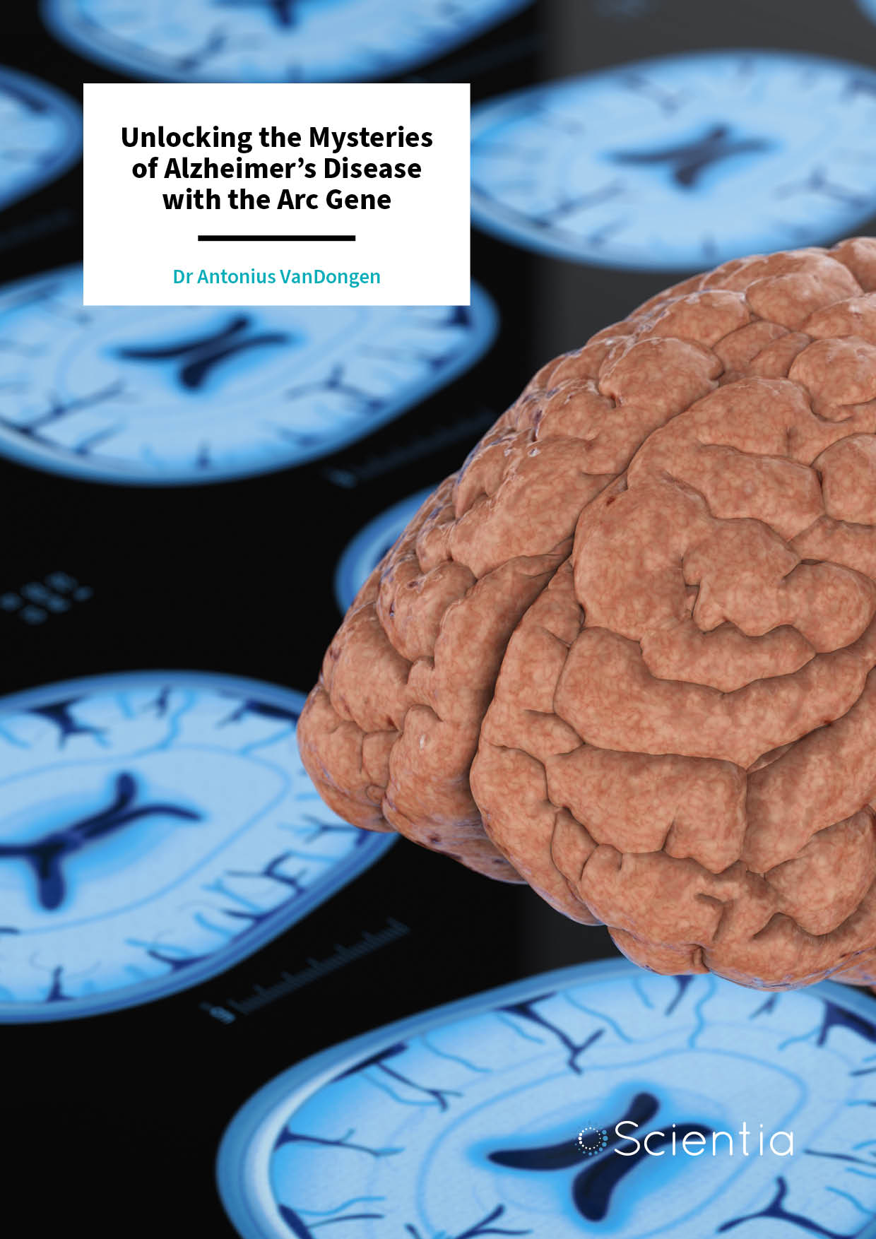 Dr Antonius VanDongen | Unlocking the Mysteries of Alzheimer’s Disease with the Arc Gene