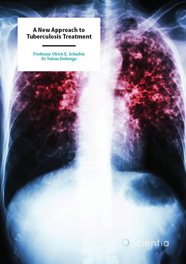 Professor Ulrich E. Schaible | Dr Tobias Dallenga – A New Approach to Tuberculosis Treatment