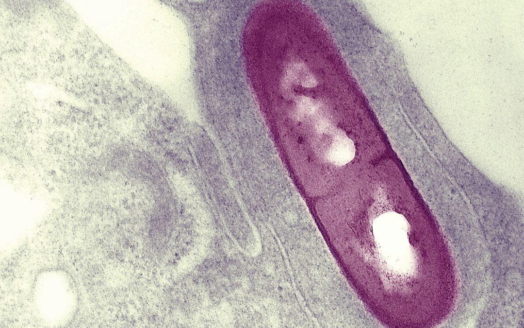 Dr Darren Higgins – Understanding the Pathogenic Mechanisms of Intracellular Bacteria