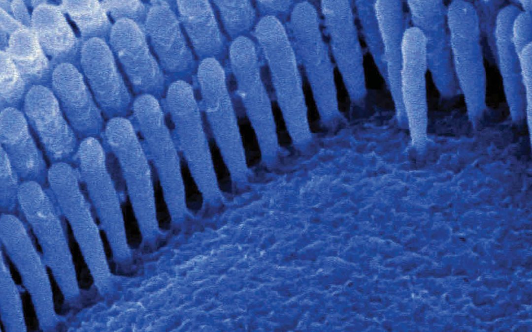 Professor David Furness – Understanding Hearing at the Cellular Level
