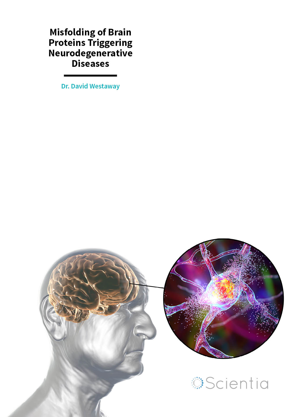 Dr. David Westaway – Misfolding of Brain Proteins Triggering Neurodegenerative Diseases