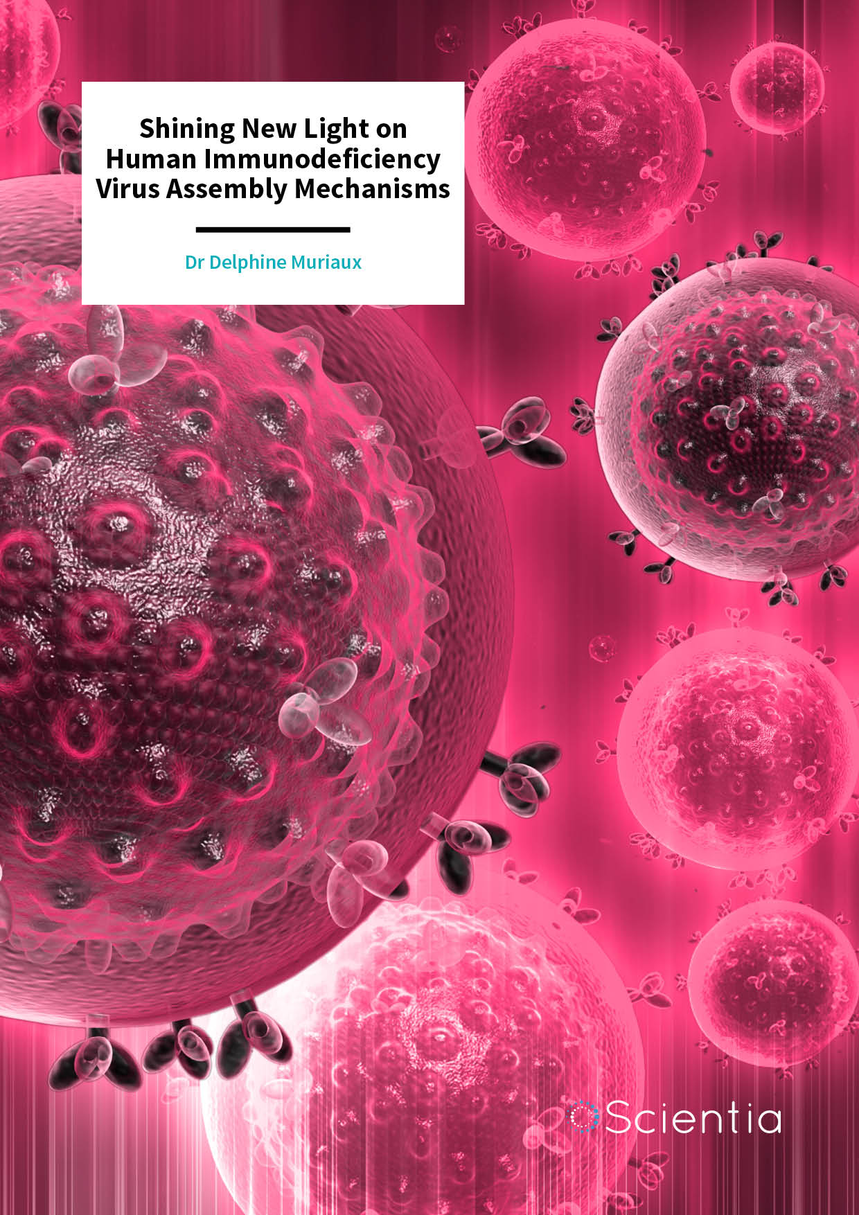 Dr Delphine Muriaux | Shining New Light on Human Immunodeficiency Virus Assembly Mechanisms