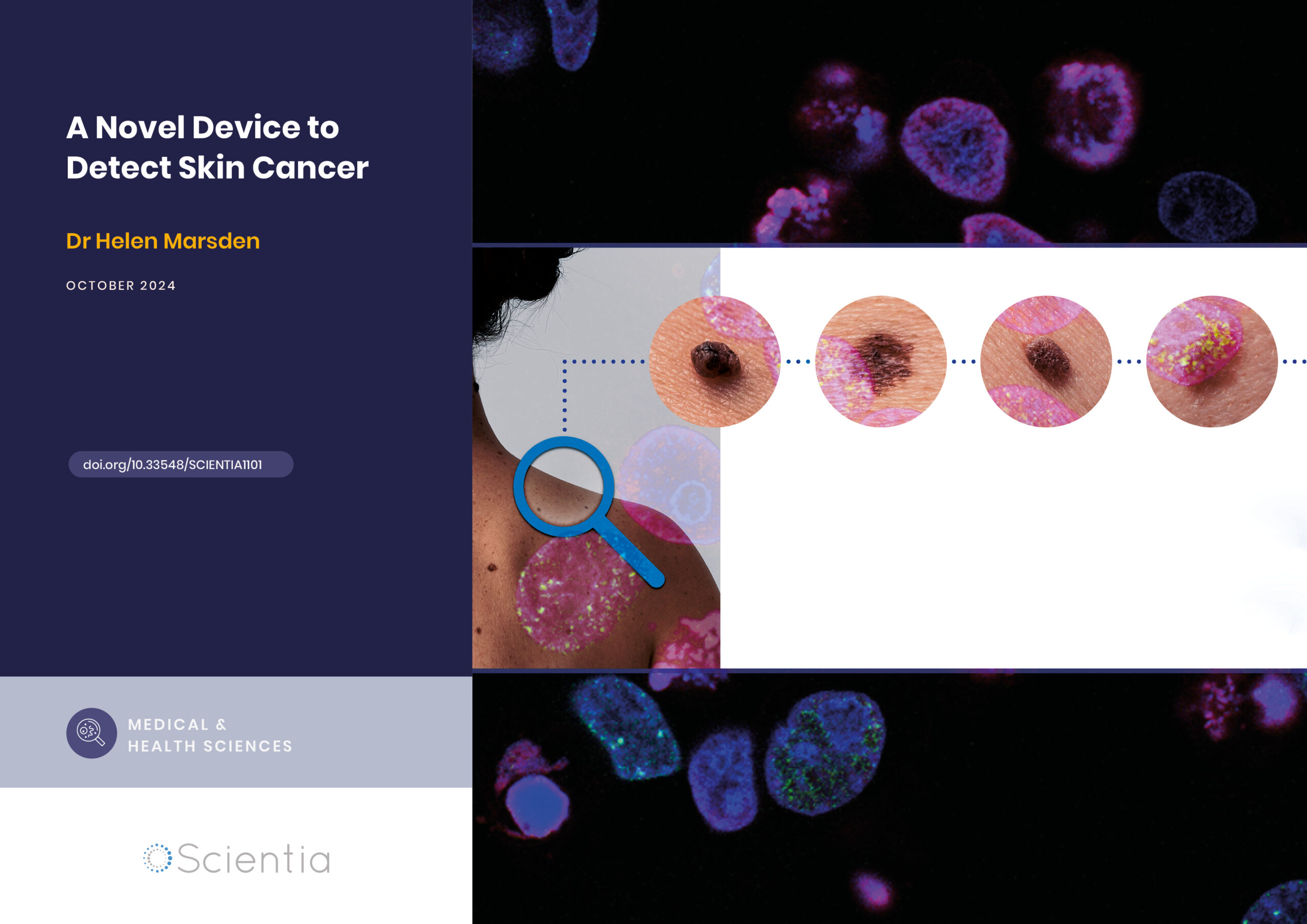 Dr Helen Marsden | DERM: A Novel Device to Detect Skin Cancer
