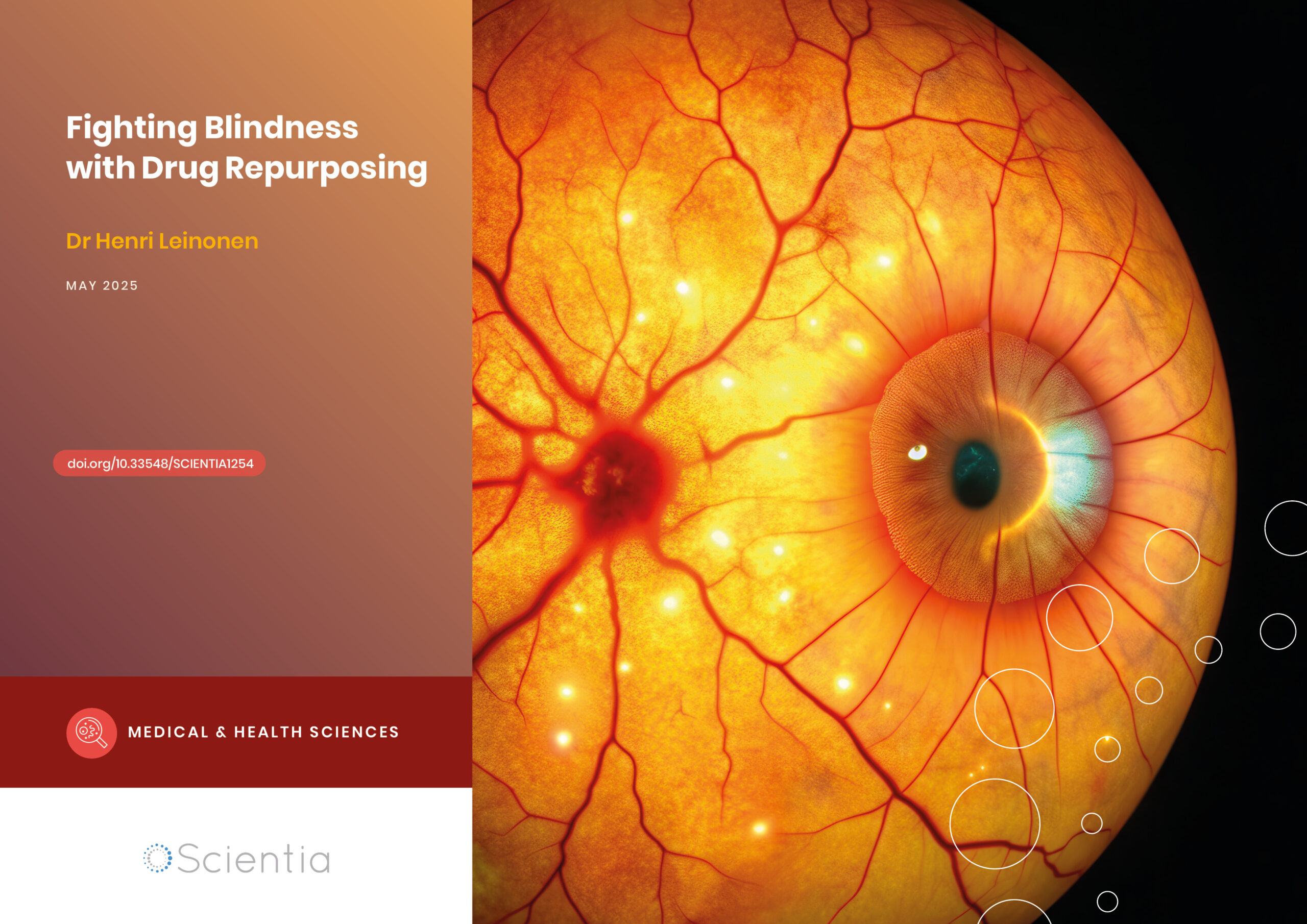 Dr Henri Leinonen | Fighting Blindness with Drug Repurposing