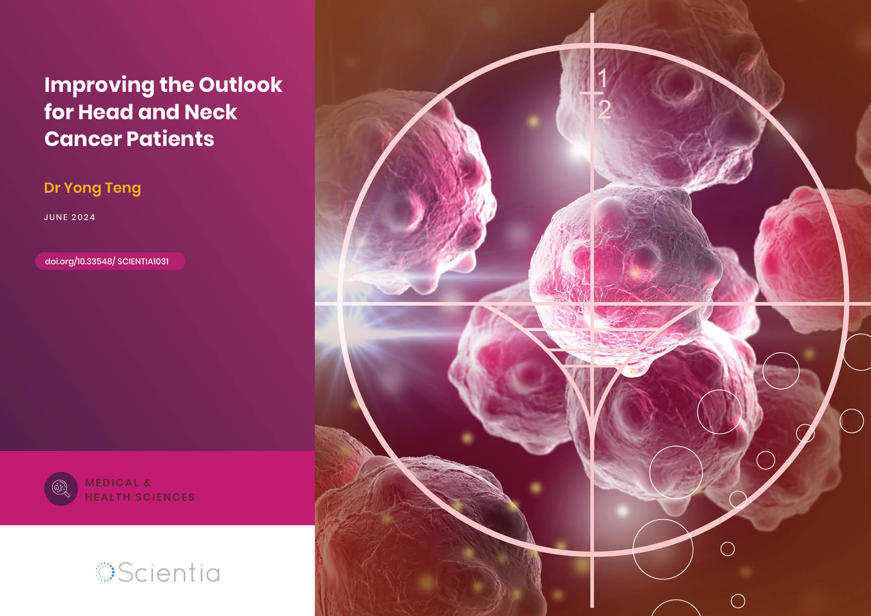 Dr Yong Teng | Improving the Outlook for Head and Neck Cancer Patients