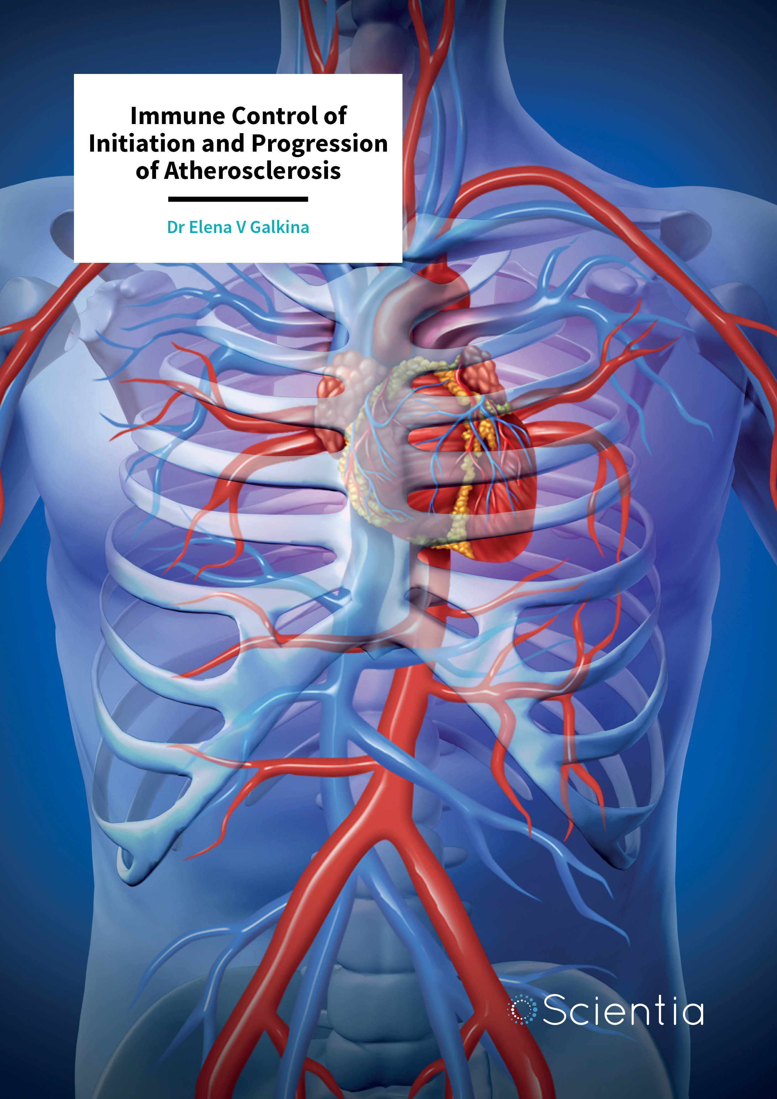 Dr Elena Galkina – Immune Control of Initiation and Progression of Atherosclerosis