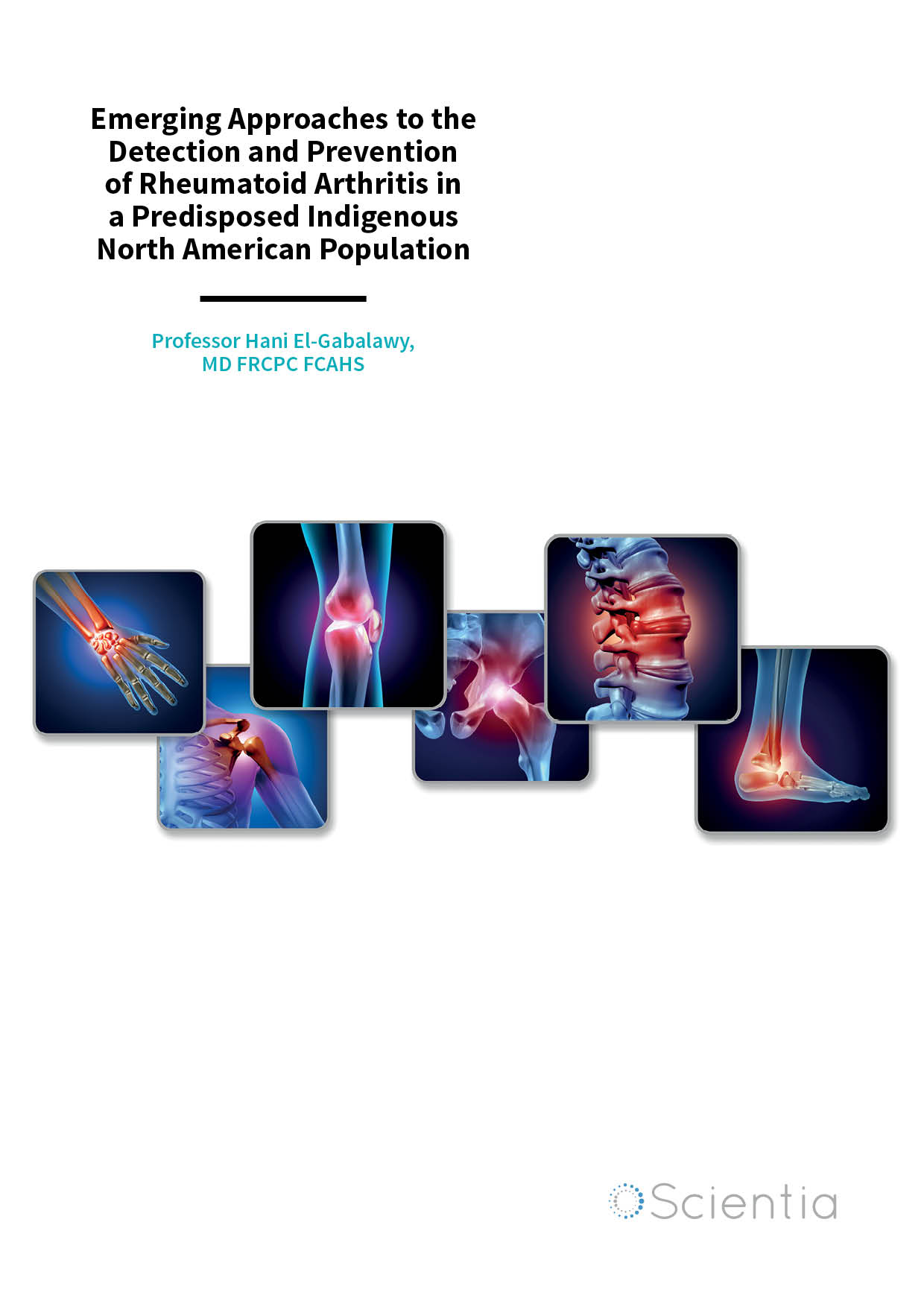 Professor Hani El-Gabalawy – Emerging Approaches to the Detection and Prevention of Rheumatoid Arthritis in a Predisposed Indigenous North American Population
