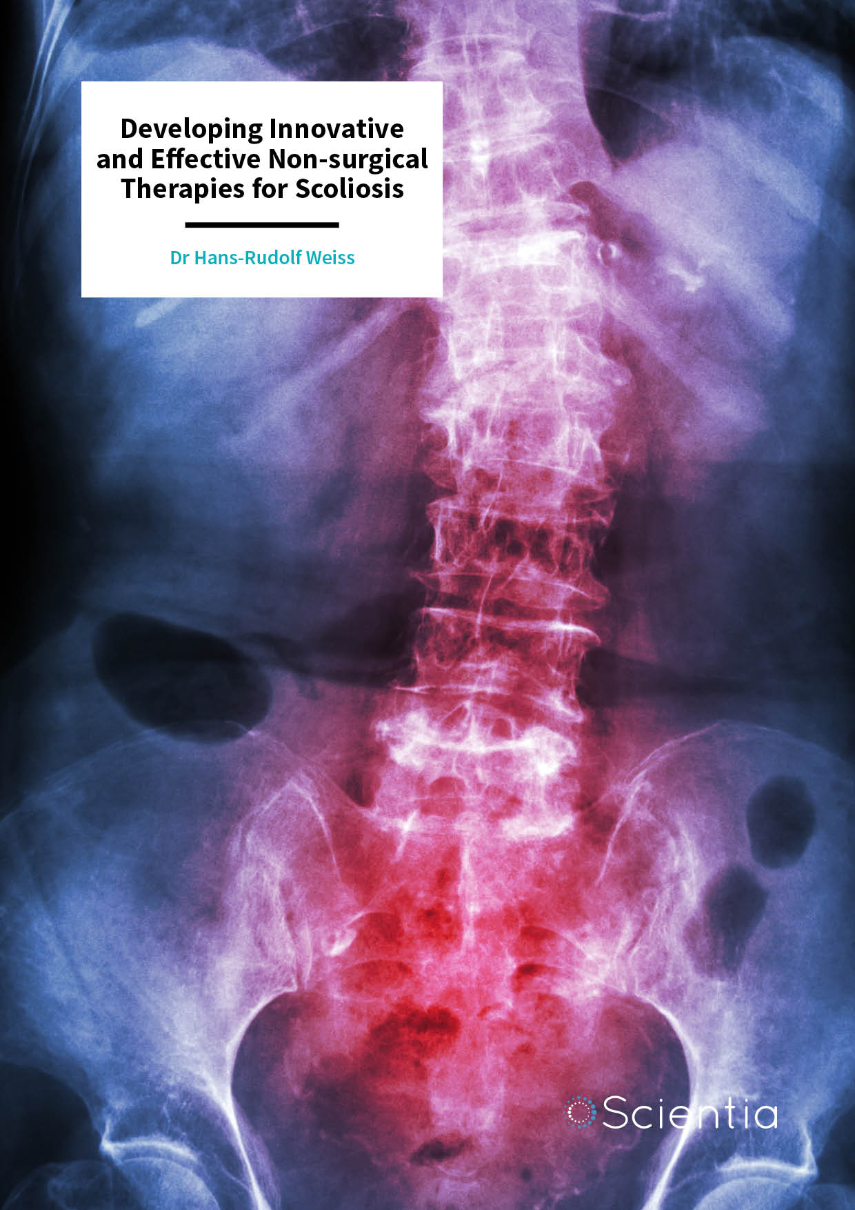 Dr Hans-Rudolf Weiss – Developing Innovative and Effective Non-surgical Therapies for Scoliosis