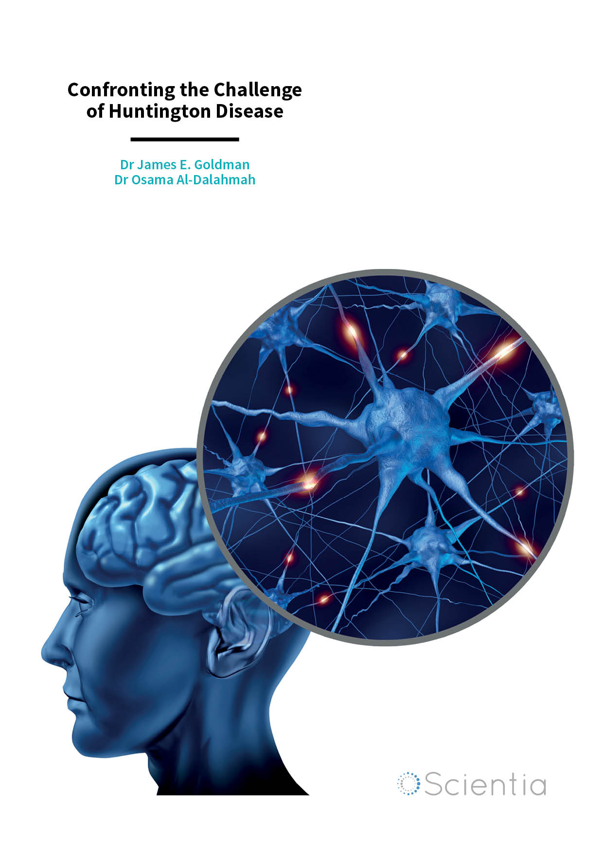 Dr James E. Goldman | Dr Osama Al-Dalahmah – Confronting the Challenge of Huntington Disease