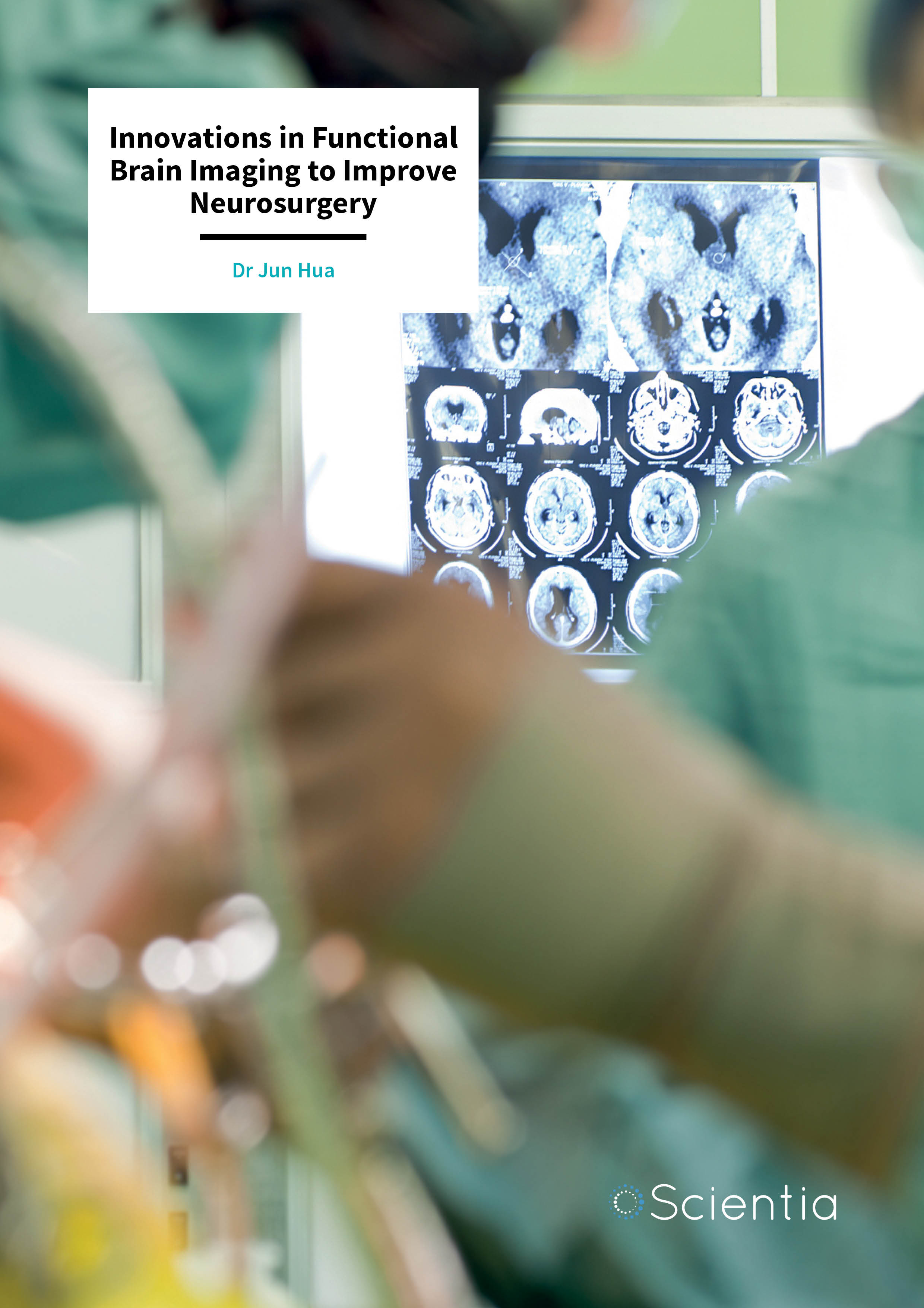 Dr Jun Hua – Innovations in Functional Brain Imaging to Improve Neurosurgery