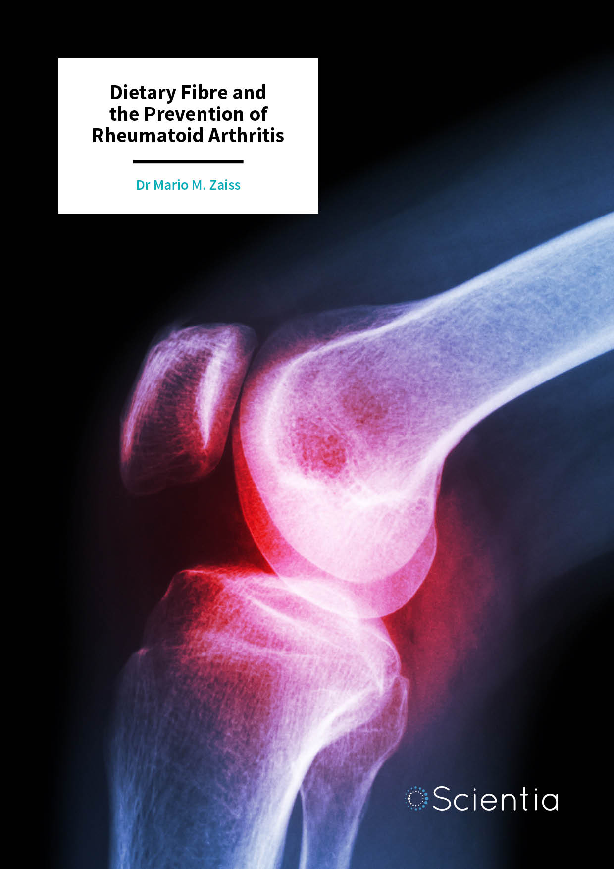 Dr Mario Zaiss – Dietary Fibre and the Prevention of Rheumatoid Arthritis
