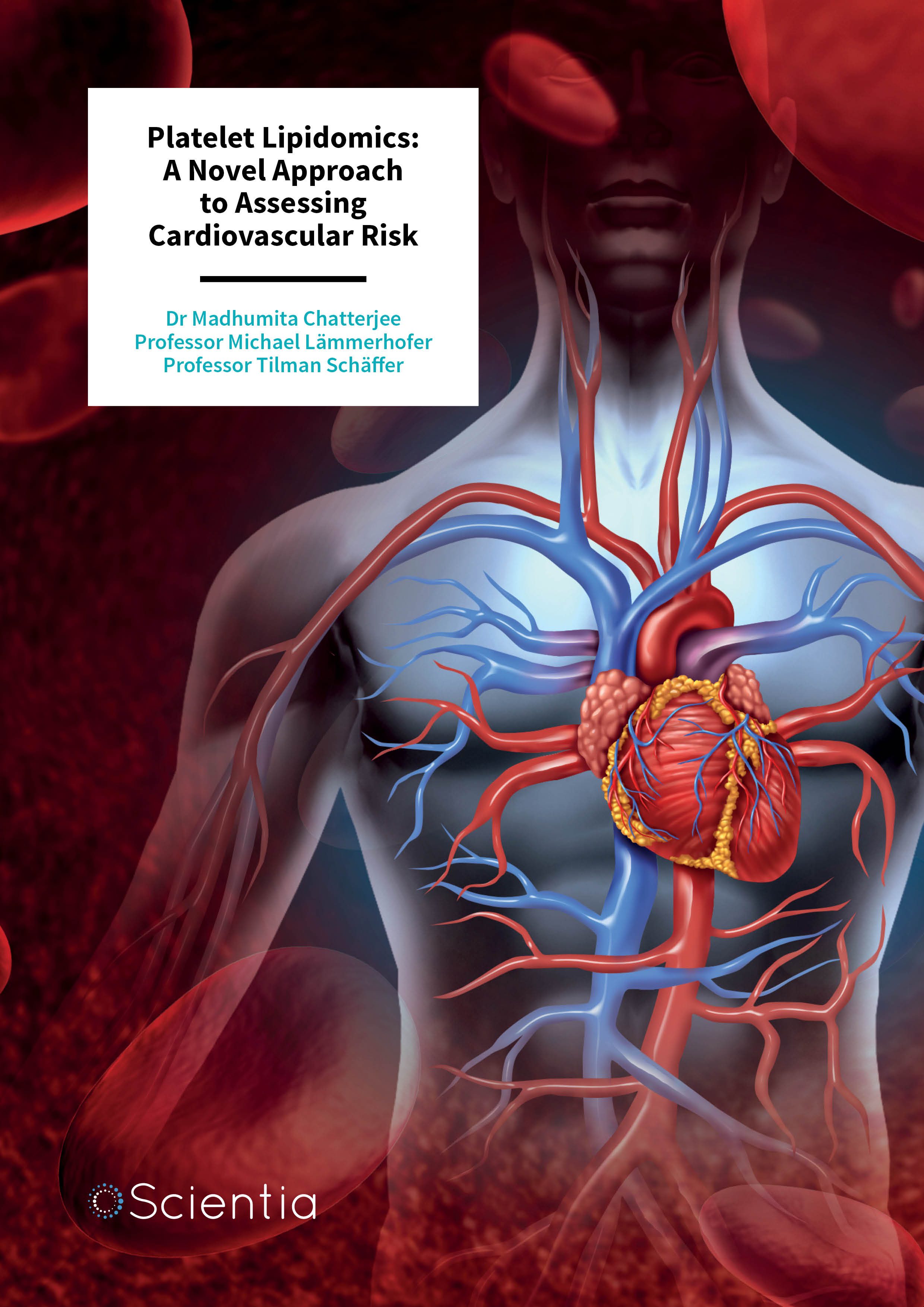 Dr Madhumita Chatterjee | Professor Michael Lämmerhofer | Professor Tilman Schäffer – Platelet Lipidomics: A Novel Approach to Assessing Cardiovascular Risk