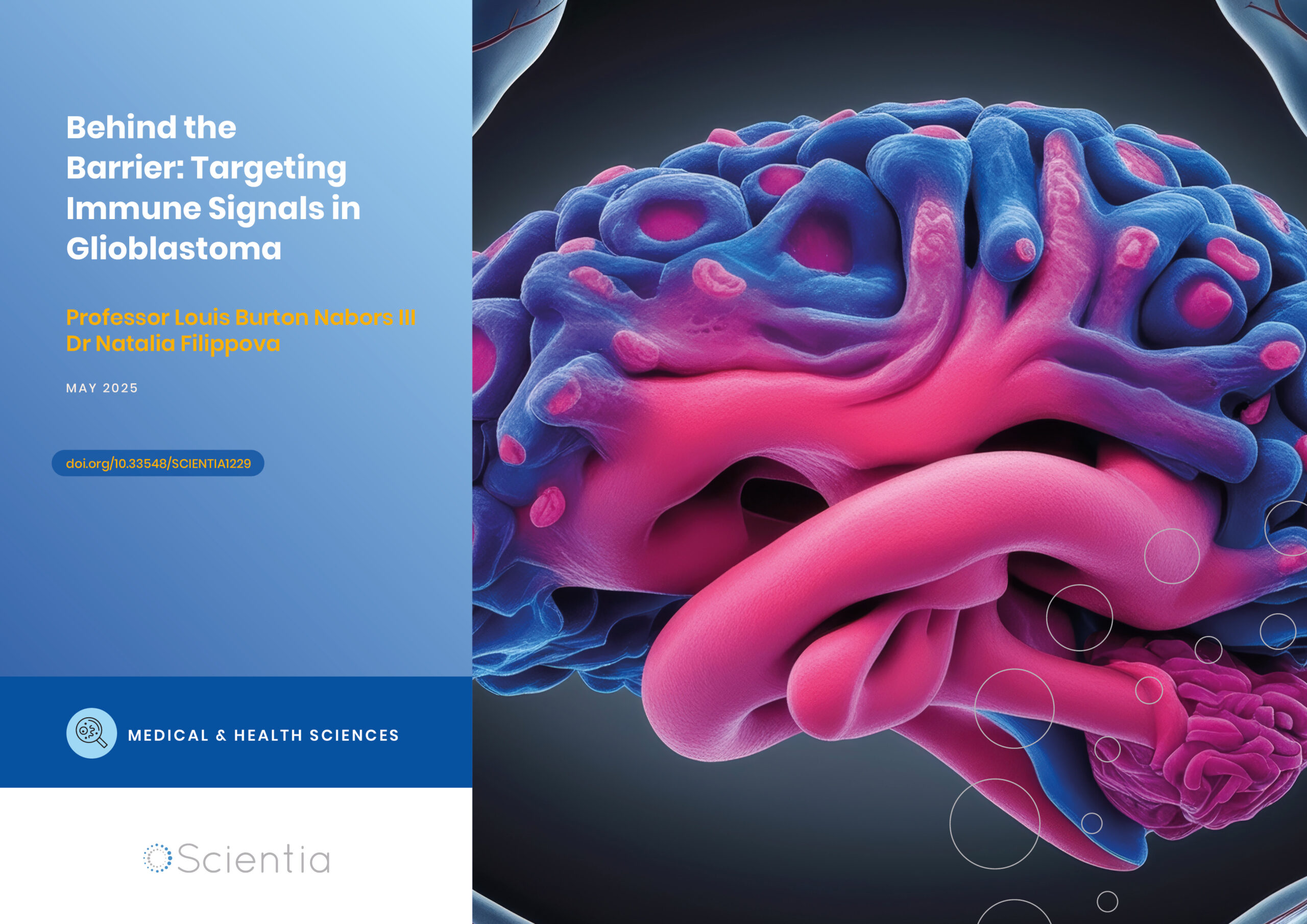 Behind the Barrier: Targeting Immune Signals in Glioblastoma