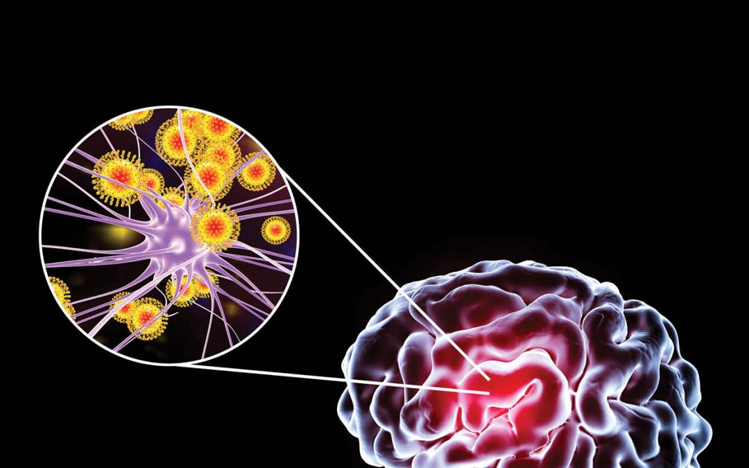 Dr Robyn S. Klein – Regulation and Loss of Neuroprotection in Viral and Autoimmune Diseases of the Central Nervous System