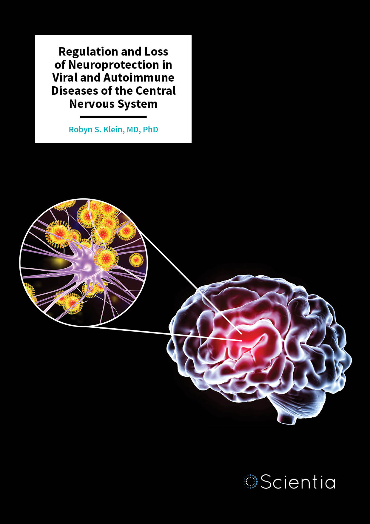 Dr Robyn S. Klein – Regulation and Loss of Neuroprotection in Viral and Autoimmune Diseases of the Central Nervous System