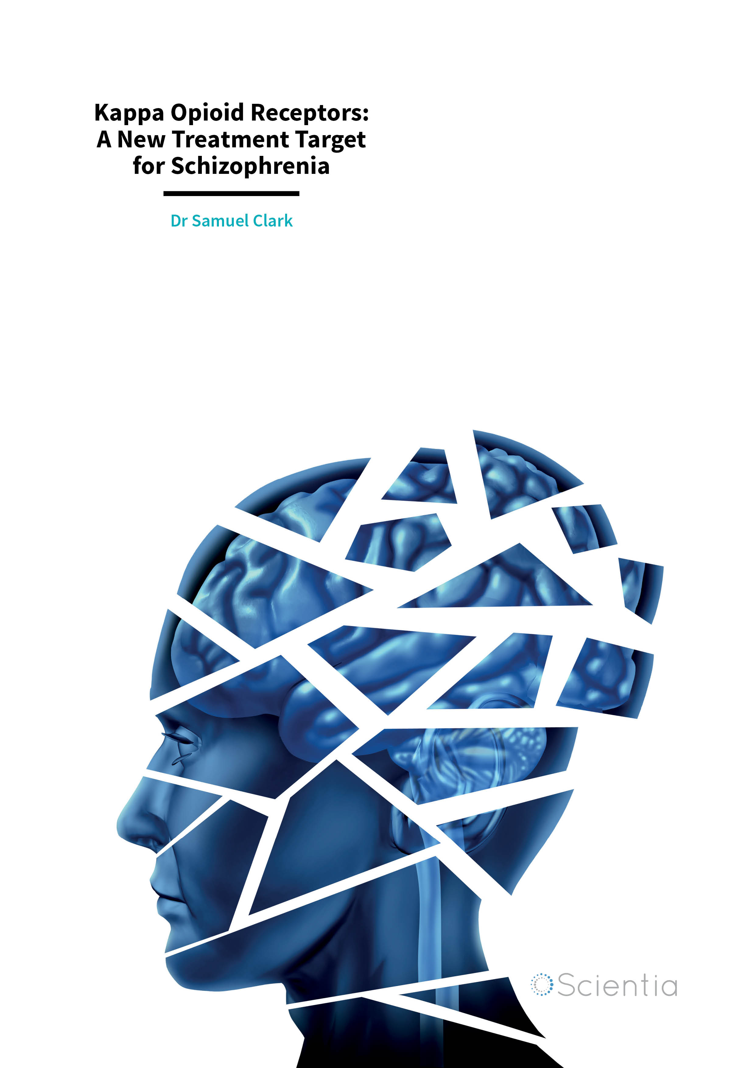 Informing DSM-5: biological boundaries between bipolar I disorder,  schizoaffective disorder, and schizophrenia | BMC Medicine | Full Text
