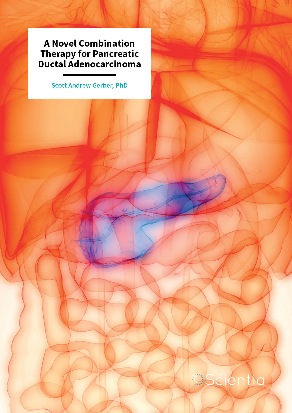 Dr Scott Gerber – A Novel Combination Therapy for Pancreatic Ductal Adenocarcinoma