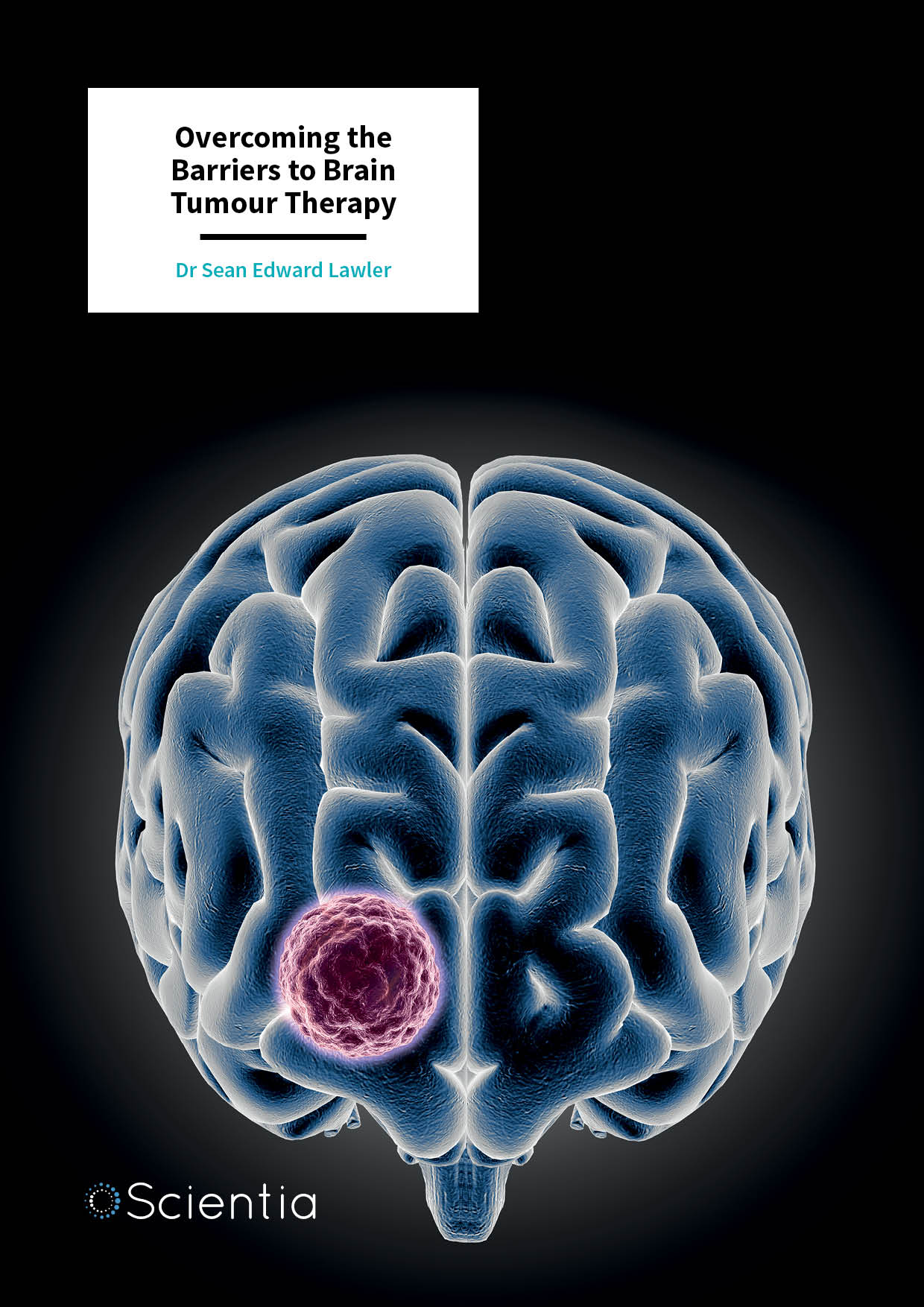 Dr Sean Lawler – Overcoming the Barriers to Brain Tumour Therapy