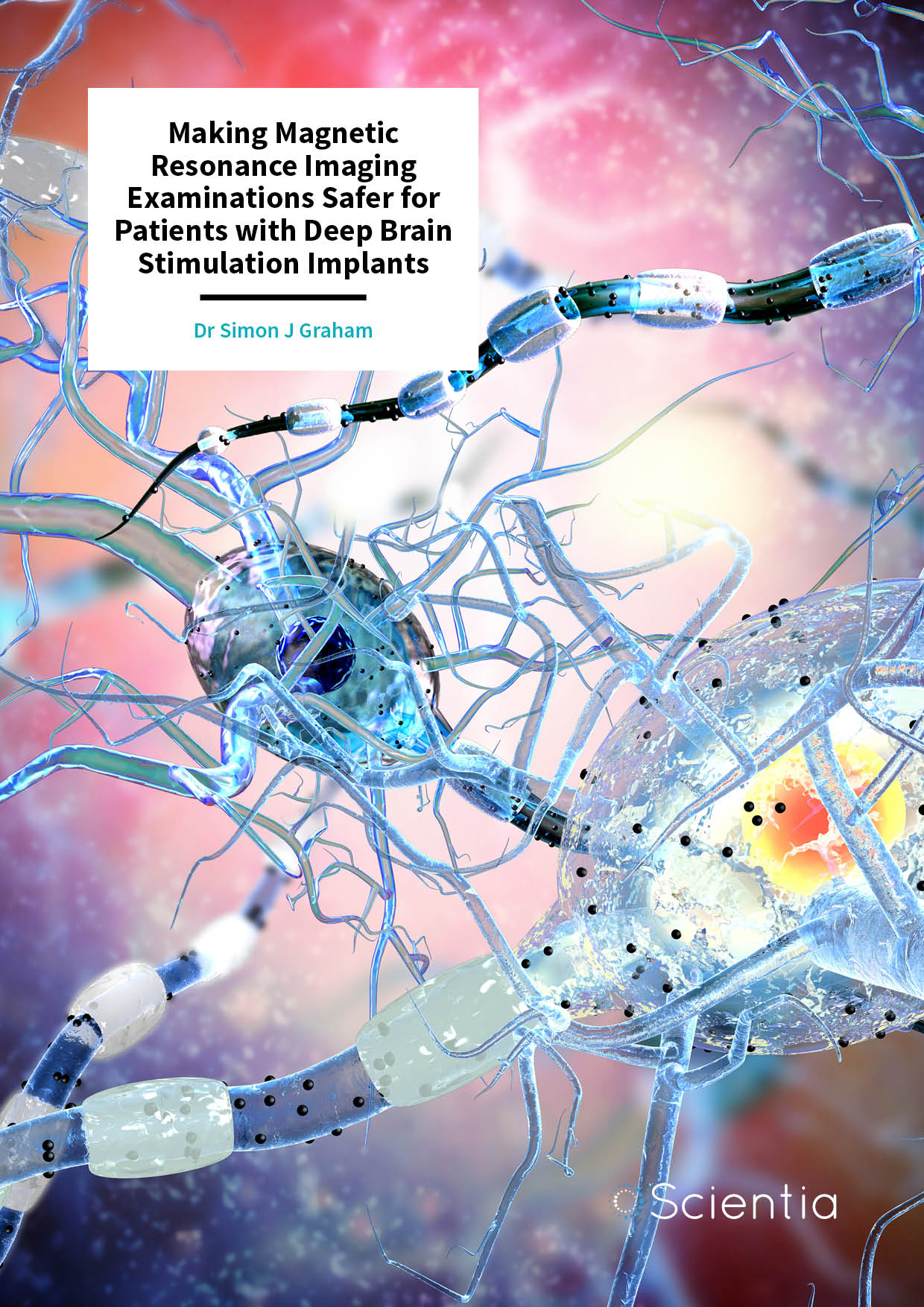 Dr Simon Graham – Making Magnetic Resonance Imaging Examinations Safer for Patients with Deep Brain Stimulation Implants