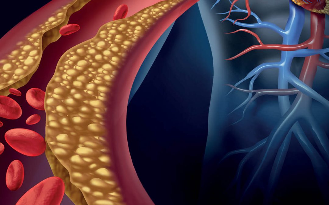 Dr Spencer Proctor – A Novel Antibody with Vaccine-like Properties to Treat Heart Disease in Diabetes