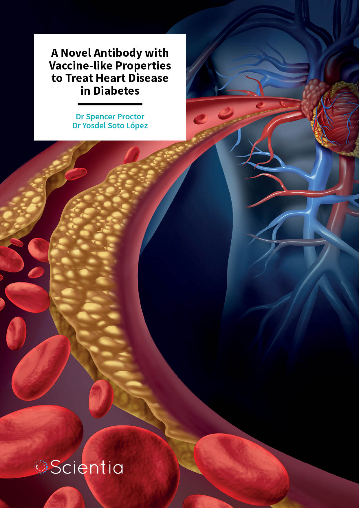 Dr Spencer Proctor – A Novel Antibody with Vaccine-like Properties to Treat Heart Disease in Diabetes