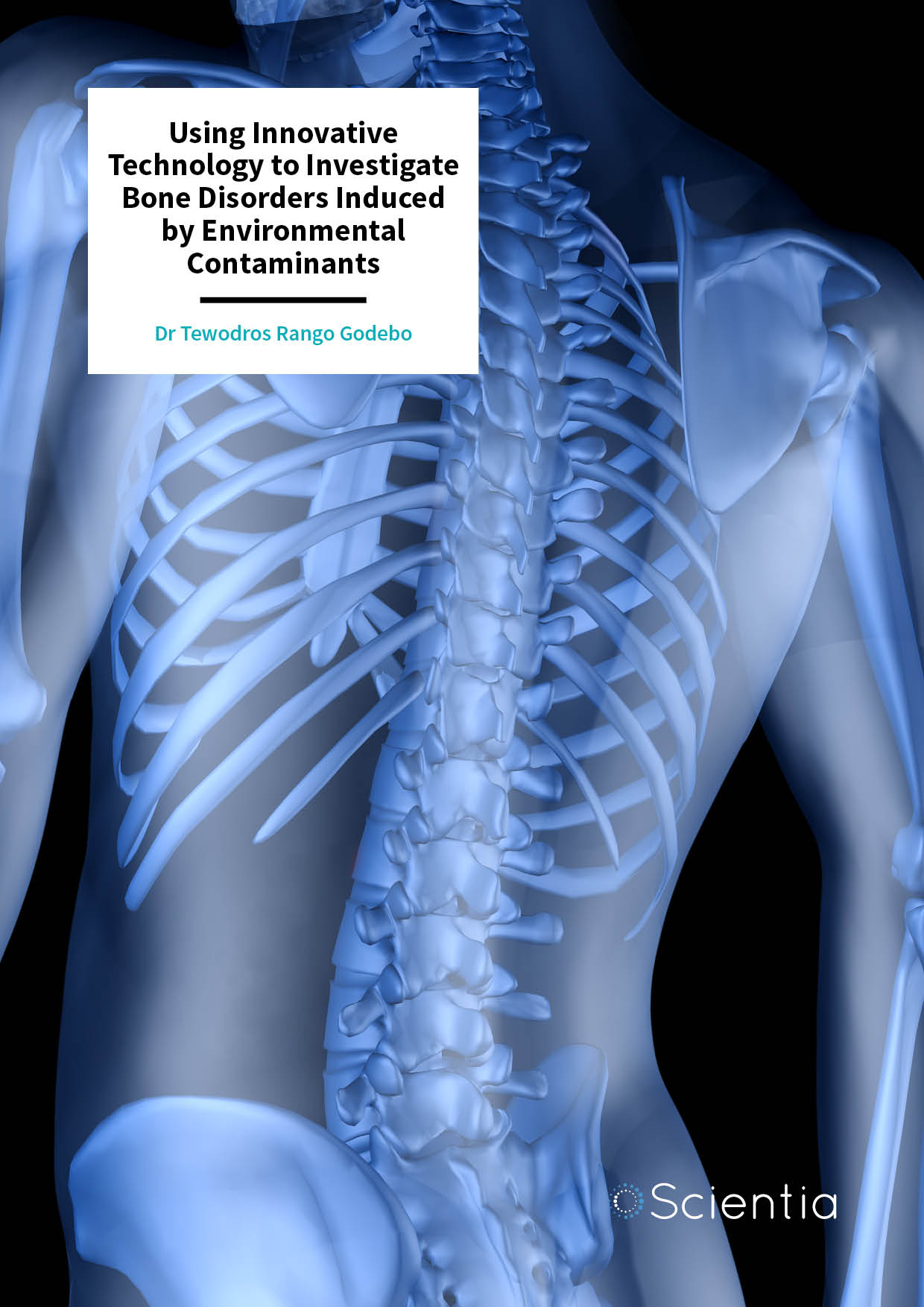 Dr Tewodros Rango Godebo – Using Innovative Technology to Investigate Bone Disorders Induced by Environmental Contaminants