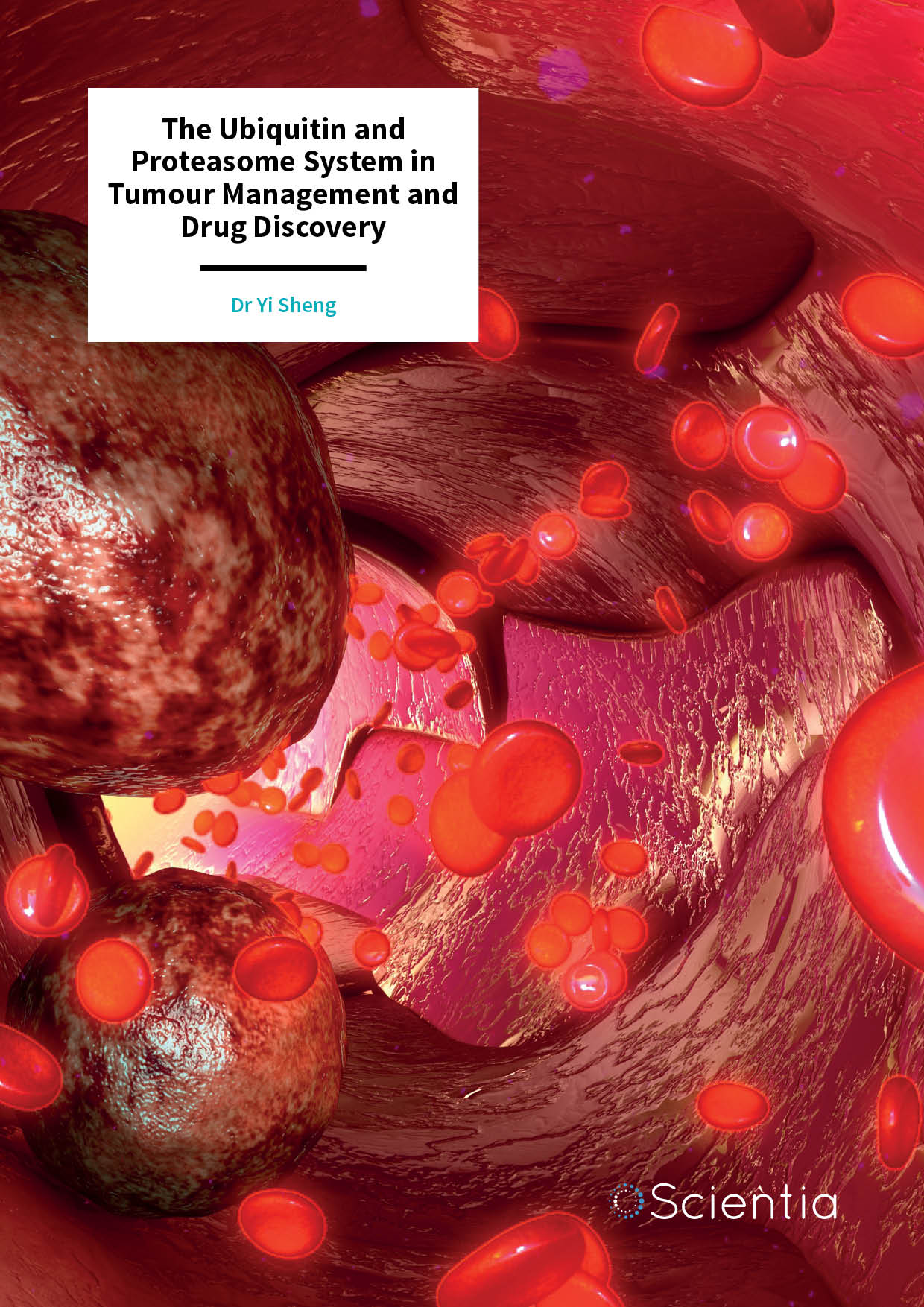 Dr Yi Sheng – The Ubiquitin and Proteasome System in Tumour Management and Drug Discovery