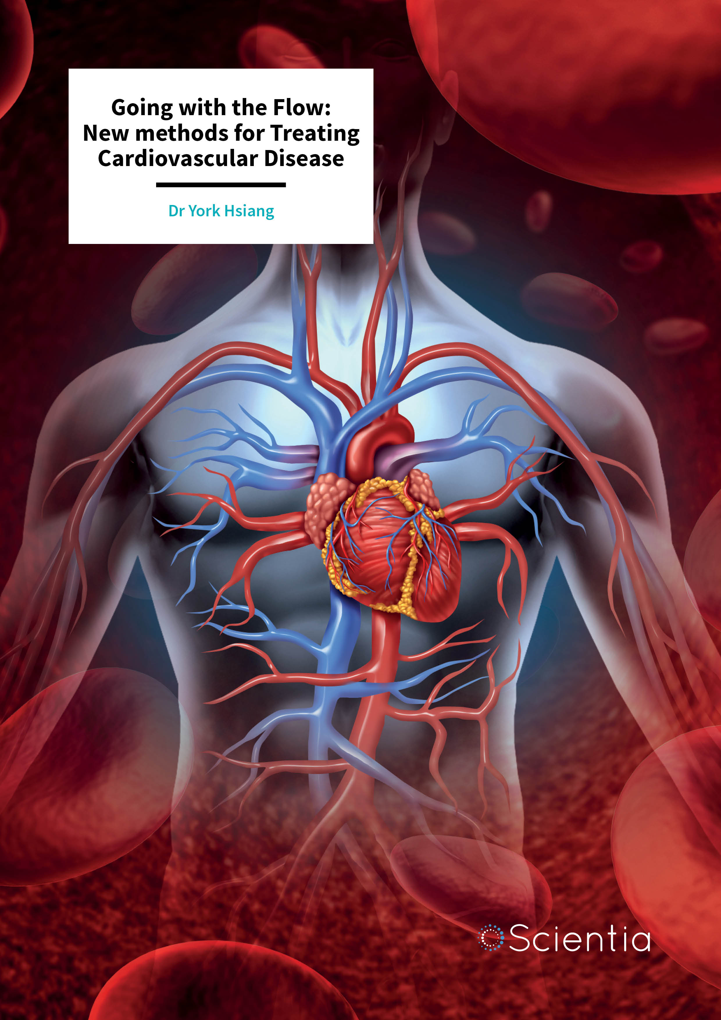 Dr York Hsiang – Going with the Flow: New methods for Treating Cardiovascular Disease