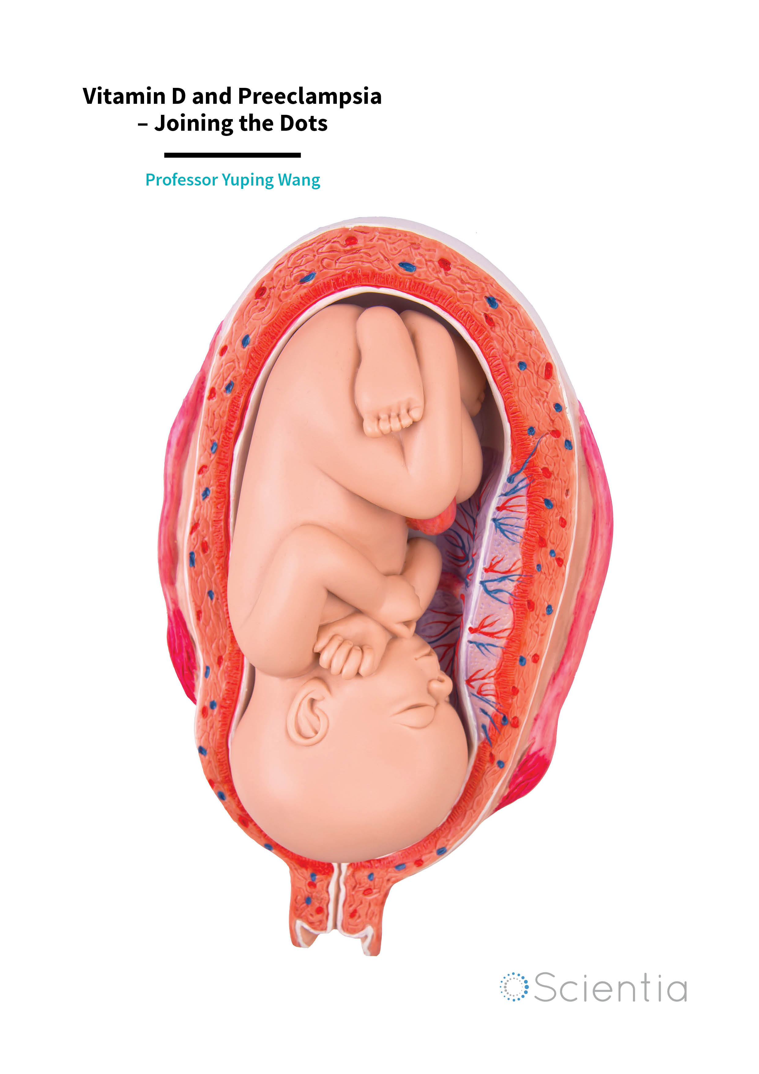 Professor Yuping Wang – Vitamin D and Preeclampsia – Joining the Dots